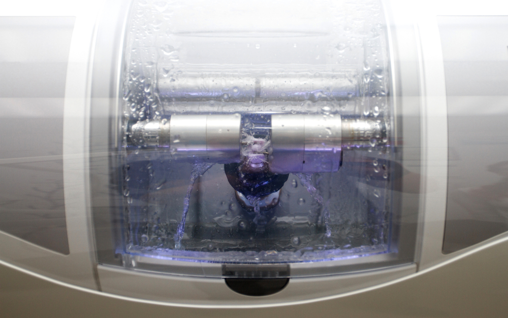 Dentiste posant un inlay ou onlay céramique à Paris 16 au cabinet Dr Teasdale.