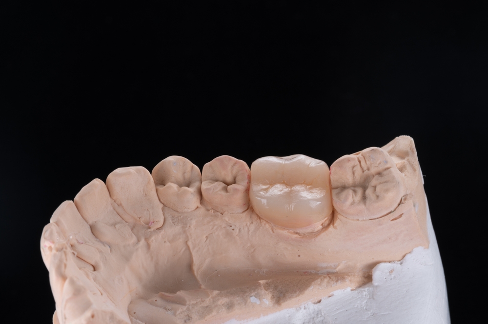 Dentiste appliquant un traitement de parodontologie biomimétique à Paris 16.